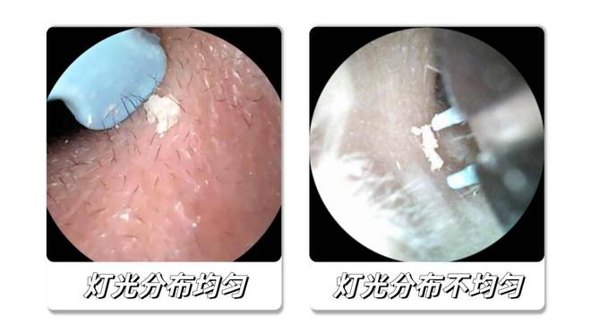 哪种挖耳勺好用不伤耳?专业测评材质安全的挖耳勺!(图6)