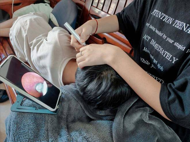 哪种挖耳勺好用不伤耳?专业测评材质安全的挖耳勺!(图10)