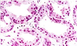 未来客Vlk骨传导助听器与科大讯飞HB-03助听器的深度对比：选择哪款更适合你？