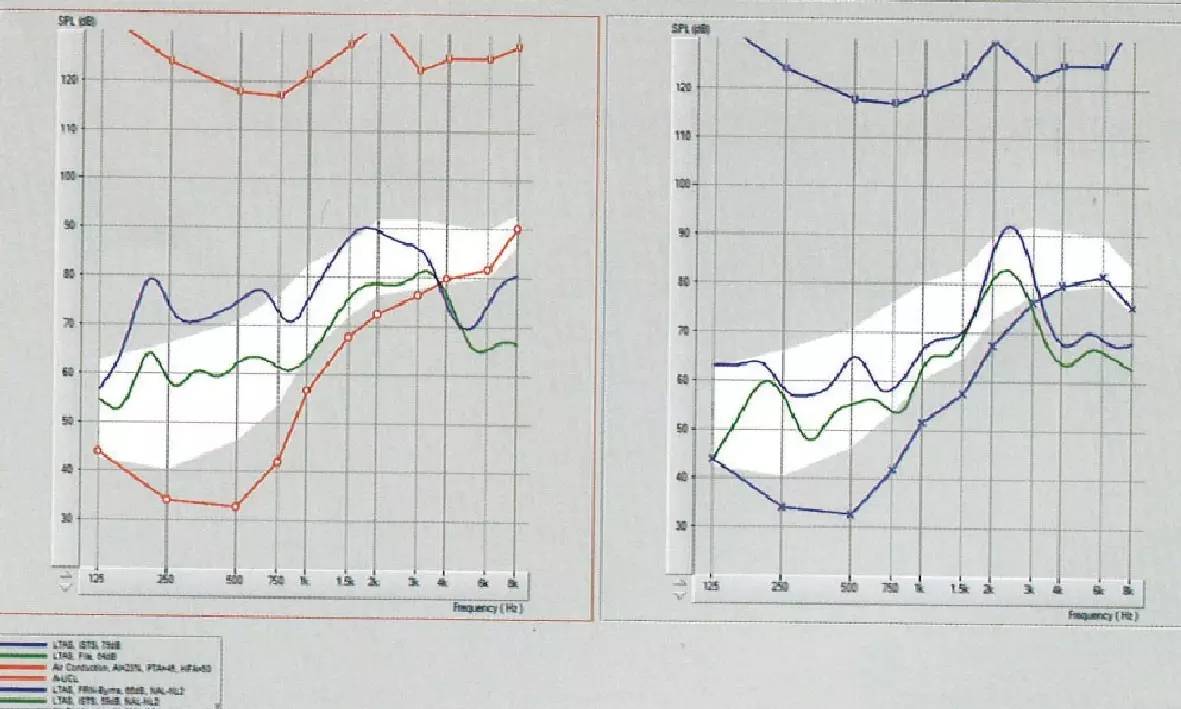 2026年真无线蓝牙耳机对比测评:vivo TWS4、AirPods Pro、索尼WF-1000XM4、华为FreeBuds Pro哪款最值得入手?(图1) 2026年真无线蓝牙耳机对比测评:vivo TWS4、AirPods Pro、索尼WF-1000XM4、华为FreeBuds Pro哪款最值得入手?