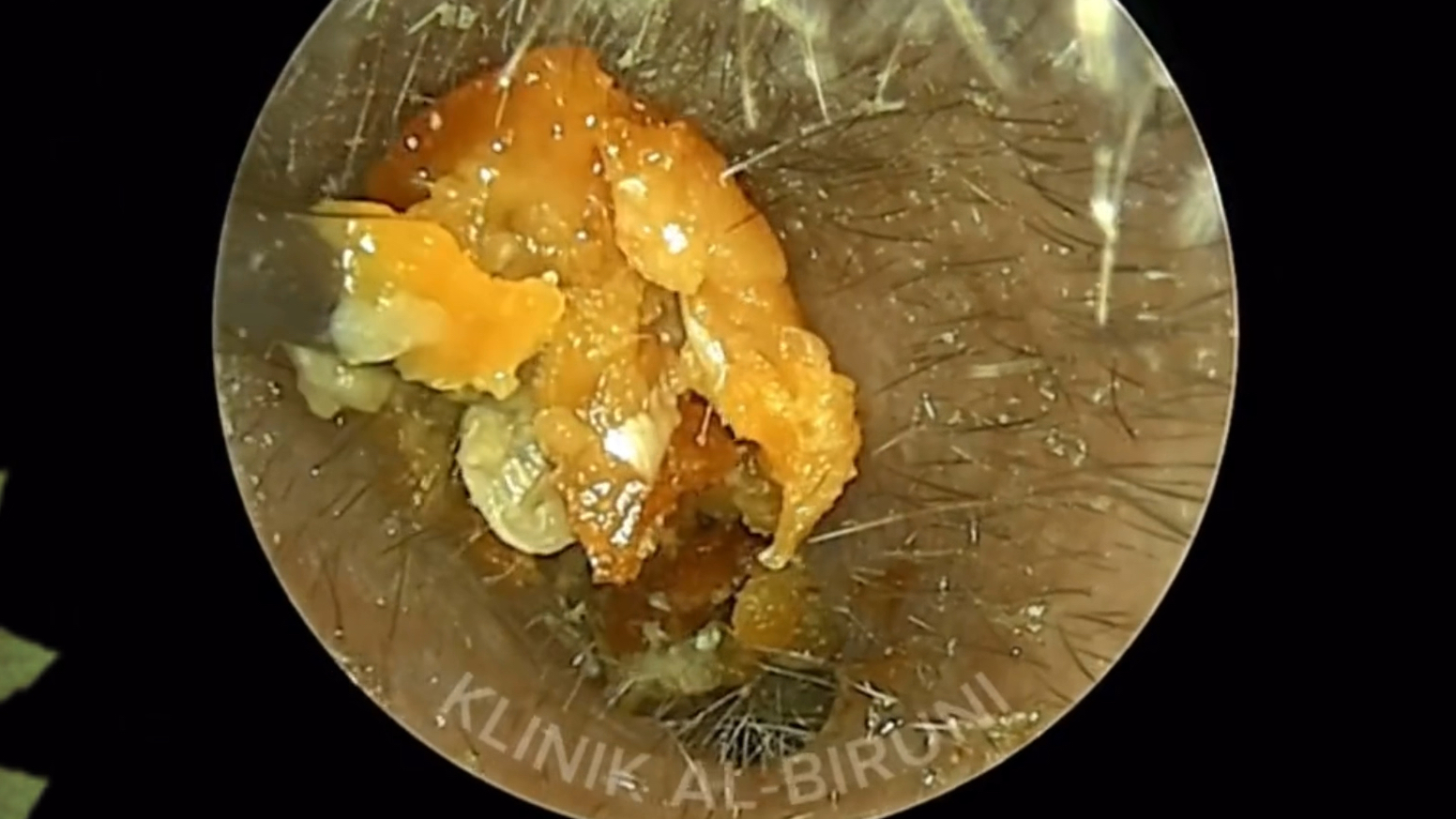 须鲸_标签_网易出品
